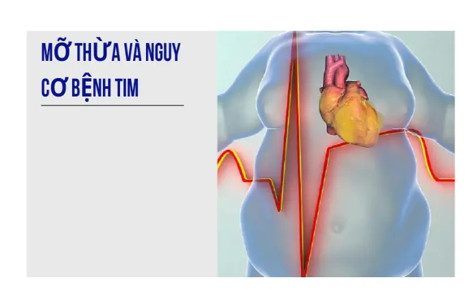 Mỡ thừa và những hệ lụy nguy hiểm tới sức khỏe bạn cần biết