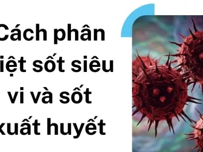 Cách phân biệt sốt siêu vi và sốt xuất huyết cực nhanh